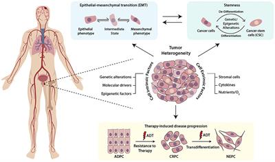 Dynamics of Cellular Plasticity in Prostate Cancer Progression